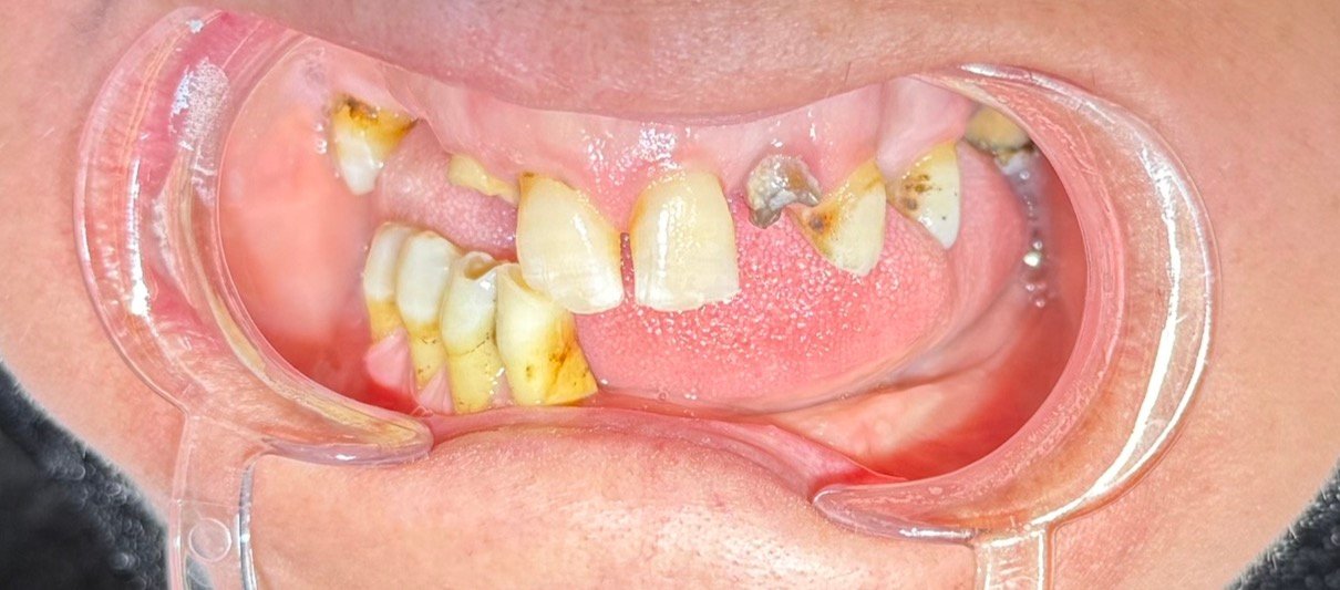 Before smile makeover